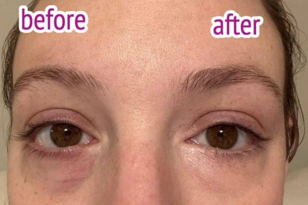 35 Products With Earlier than And Afters That’ll Assemble You Conclude A Spit Take