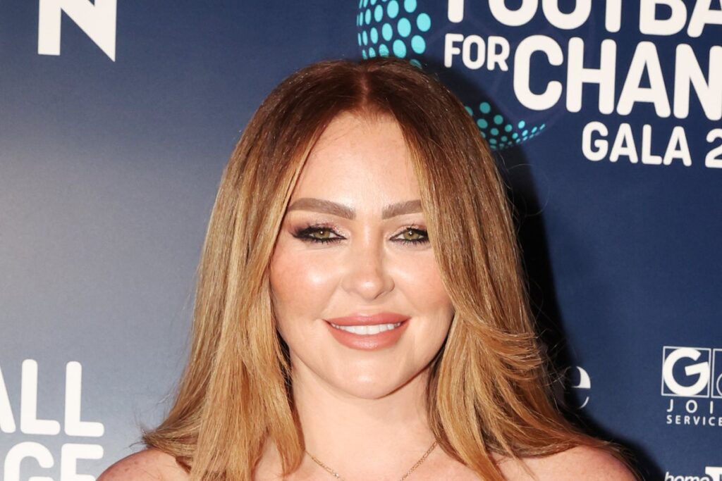 Atomic Kitten singer unearths pores and skin cancer prognosis